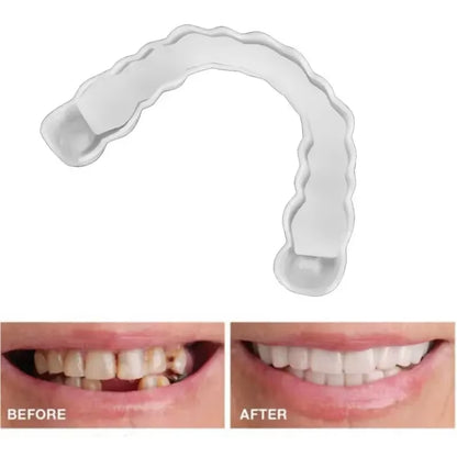 Transform Your Smile with Comfort Fit Flex Veneers - Perfect Bright Fake Teeth Cover for a Radiant White Smile!